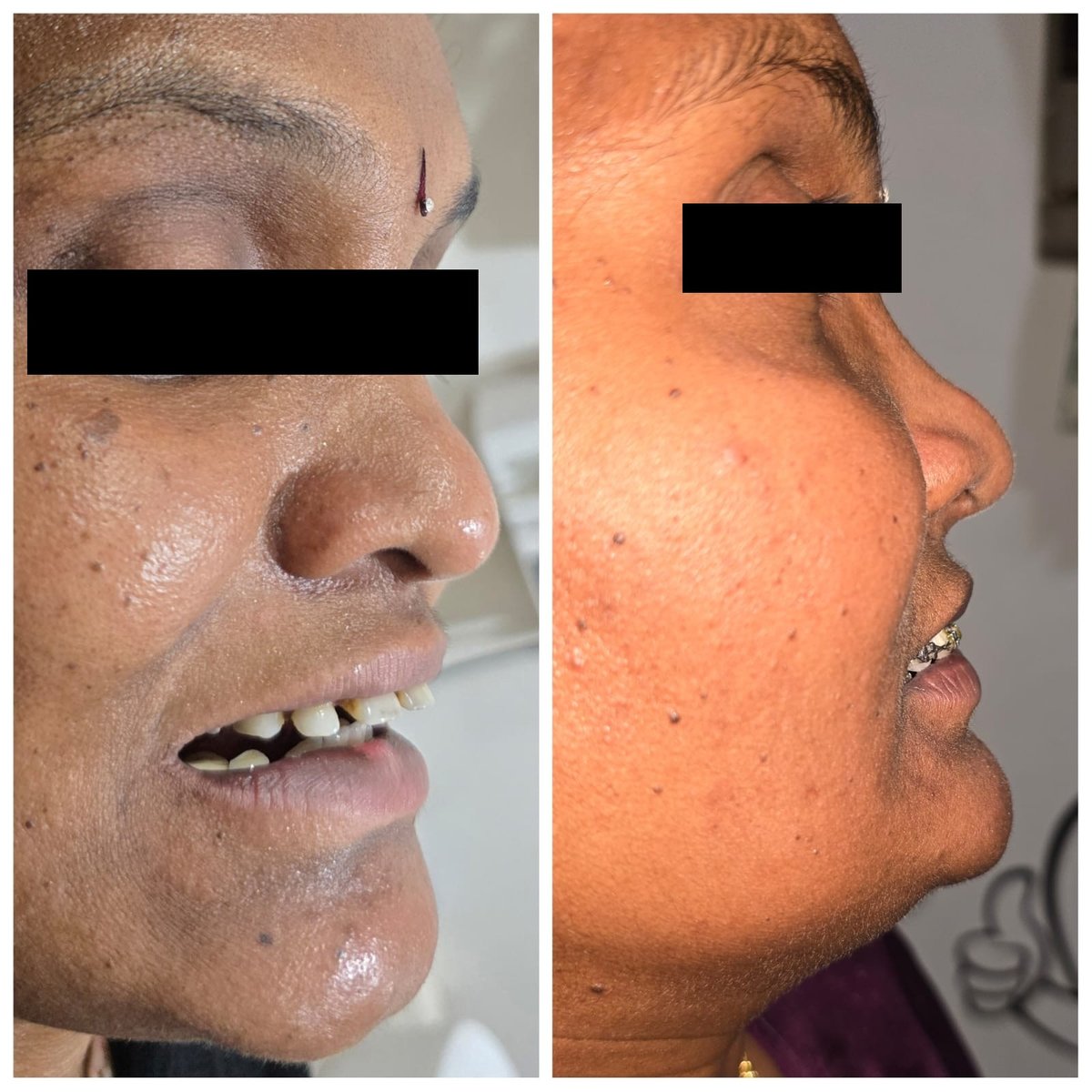 Before and after treatment