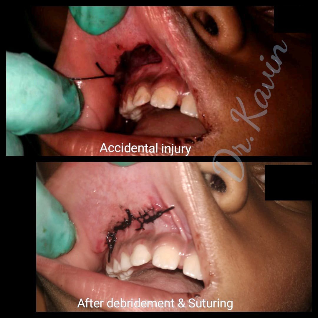 Treatment of Accidental Injuries — before and after, patient 1