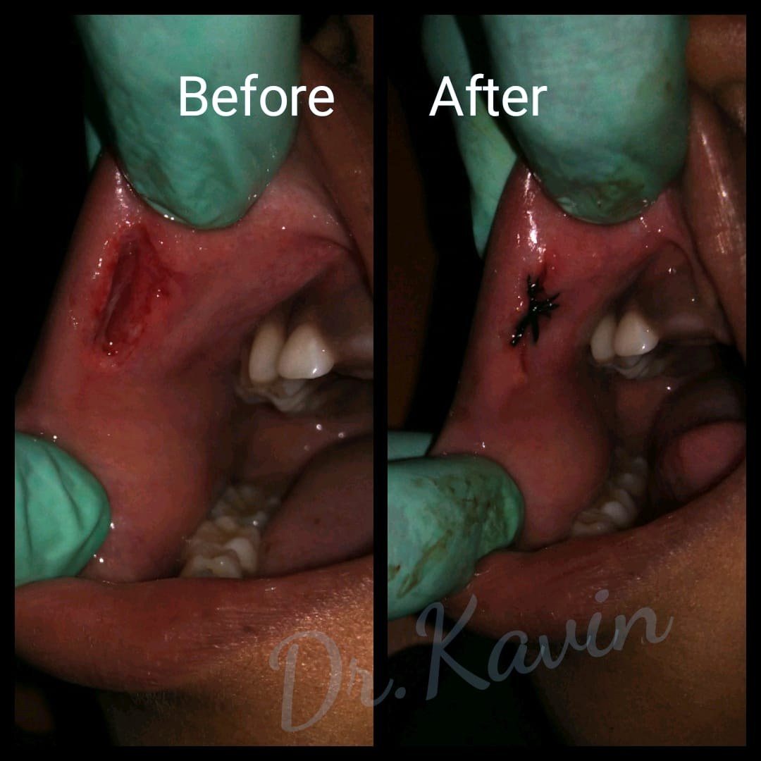 Treatment of Accidental Injuries — before and after, patient 2